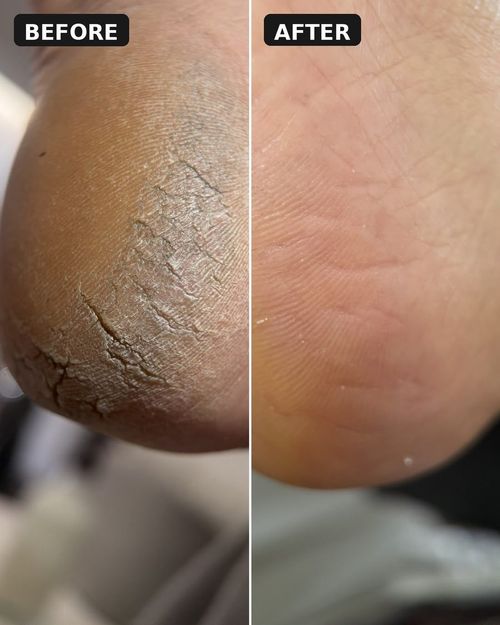 Dry Russian Pedicure by Sky Spa